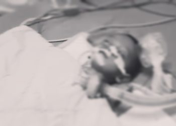 Umar Ayyasy Balita tiga tahun gejala gizi buruk Meninggal Dunia. dok. (Istimewa)
