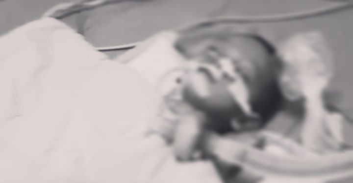 Umar Ayyasy Balita tiga tahun gejala gizi buruk Meninggal Dunia. dok. (Istimewa)
