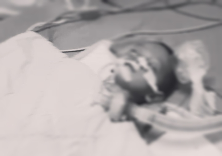 Umar Ayyasy Balita tiga tahun gejala gizi buruk Meninggal Dunia. dok. (Istimewa)